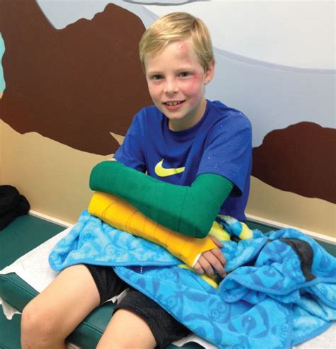 For covering up, you could get a cape or poncho. . Two broken arms story